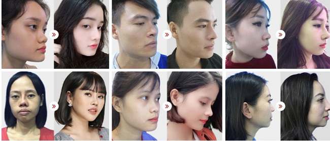 khách hàng bvtm kangnam