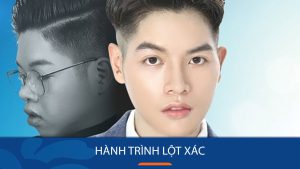 Hành trình lột xác Sốc – Đức Phúc nâng mũi, độn cằm và tạo hình môi 0đ