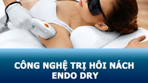 Trị hôi nách Endo Dry: Công nghệ tiên tiến, loại bỏ mùi nhanh chóng, không sẹo
