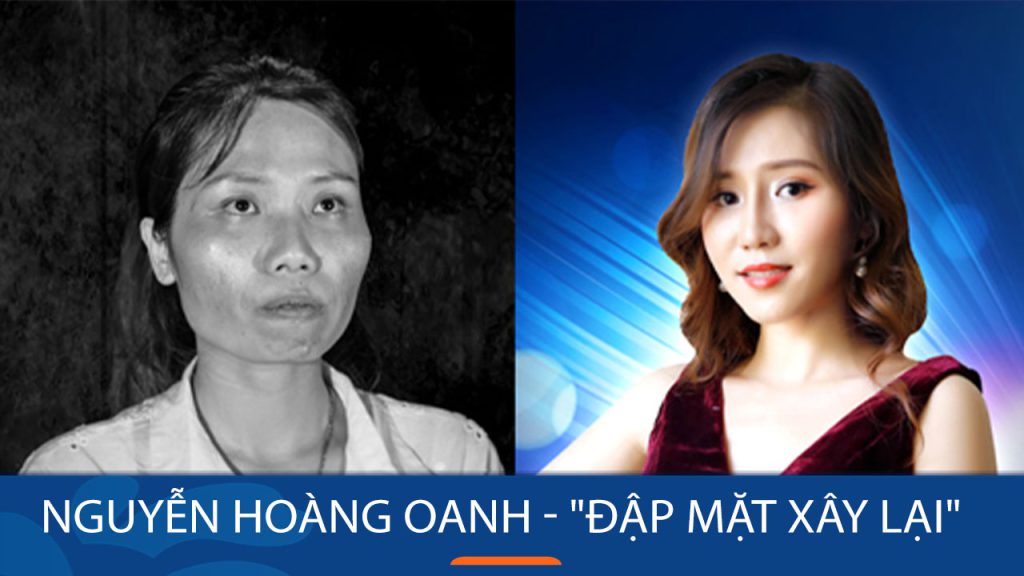 Nguyễn Hoàng Oanh – “Đập mặt xây lại” để chạm đến hạnh phúc đích thực