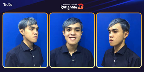 Cao Bùi Xuân Vinh khuyết điểm