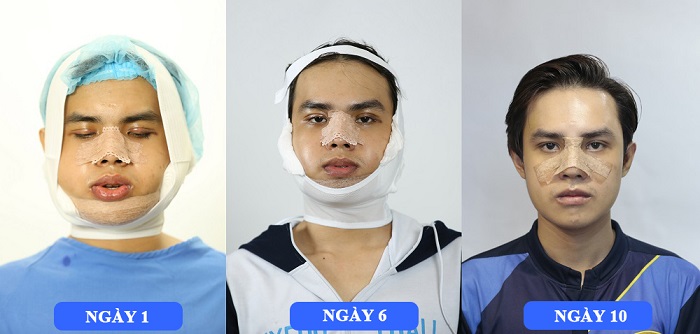 Cao Bui Xuan Vinh - hành trình lột xác 3