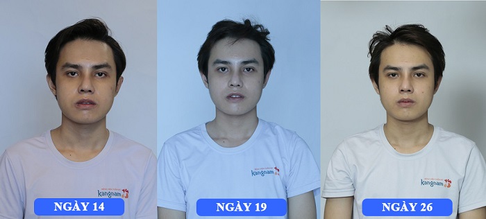 Cao Bui Xuan Vinh - hành trình lột xác 4