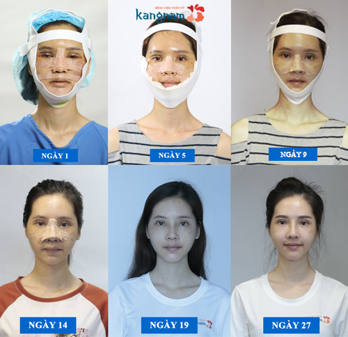 Phan Thị May Hành trình lột xác 2018 - 3