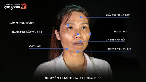 Quá trình phẫu thuật nguyễn hoàng oanh - hành trình lột xác 2018 1