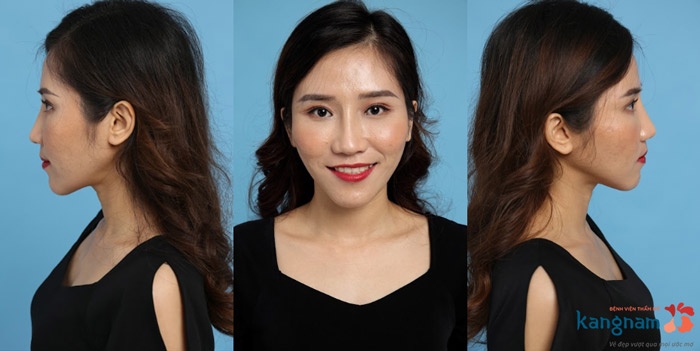 hình ảnh sau lột xác hoàng oanh