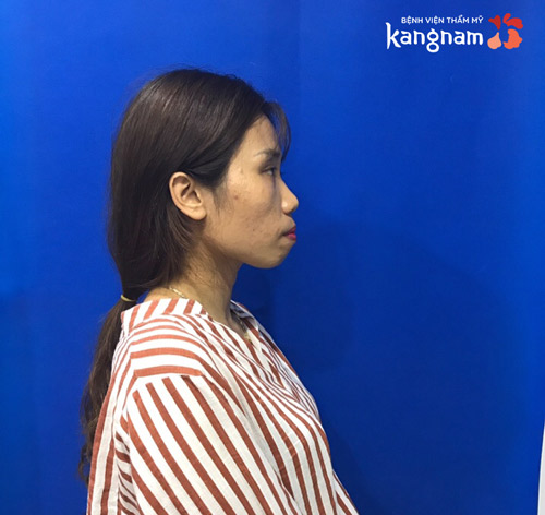 hoàng oanh trước khi lột xác