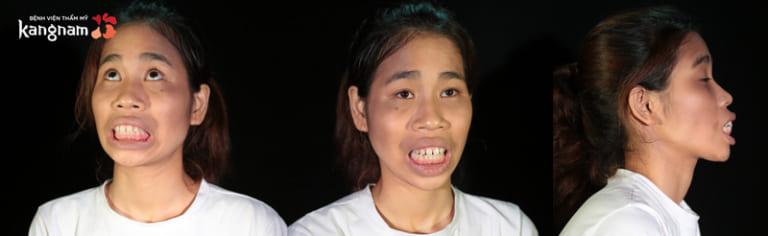 Cao Thị Lan Hành trình lột xác 2018 - 3