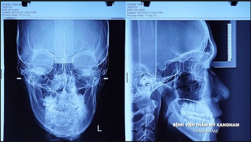 Minh hoàng hành trình lột xác 2019
