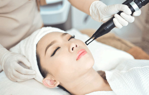 bắn mụn thịt quanh mắt