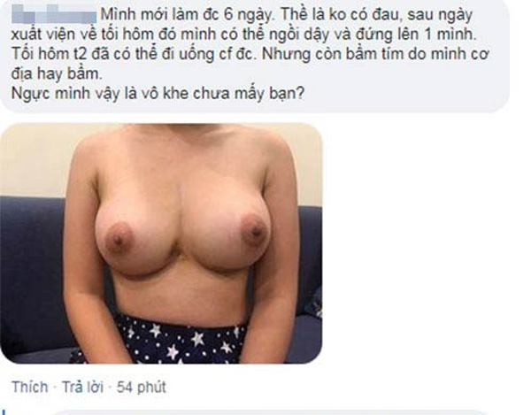 review nâng ngực chảy xệ có đau không nâng ngực chảy xệ có đau không