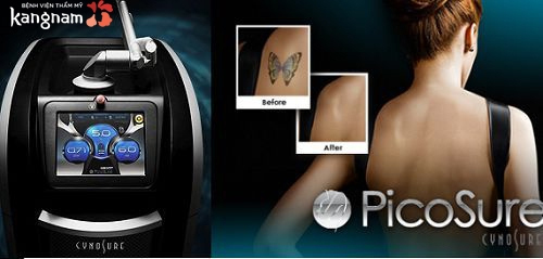 xóa xăm lông mày có để lại sẹo