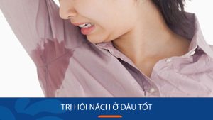 Review trị hôi nách ở đâu tốt nhất Tp Hồ Chí Minh?