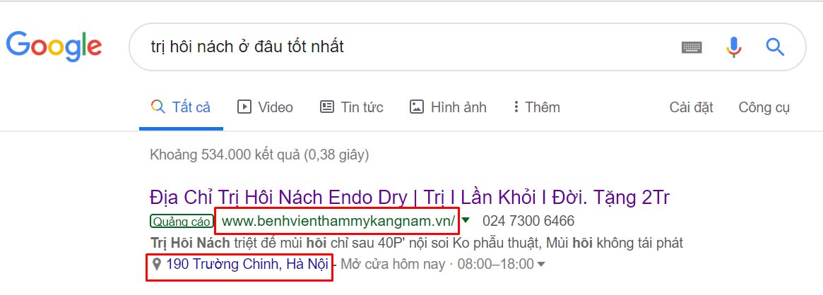 trị hôi nách tại kangnam