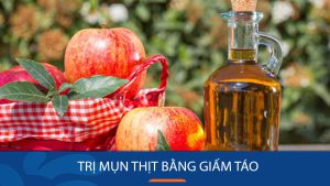 5 Cách trị mụn thịt bằng giấm táo, hiệu quả