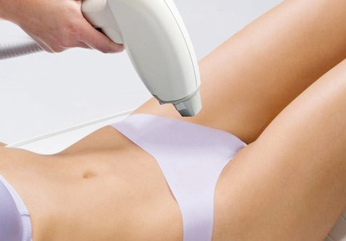 triệt lông vùng kín 