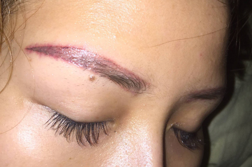 xóa xăm lông mày tại nhà