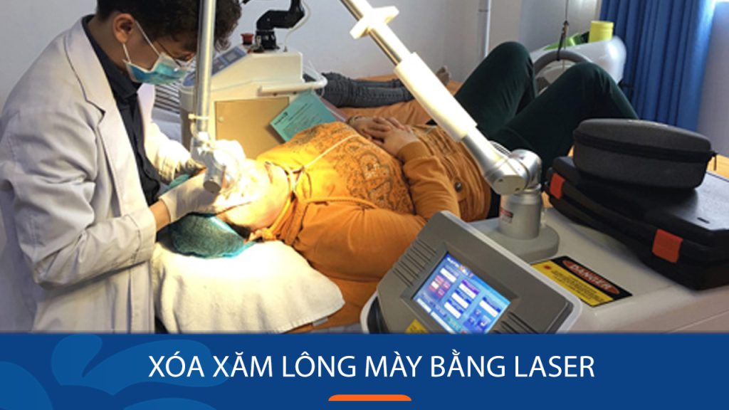 Xóa xăm lông mày bằng Laser – Giải pháp an toàn, hiệu quả