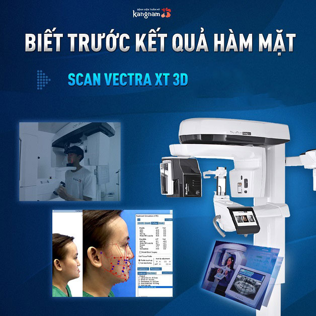 Xem trước kết quả bằng công nghệ Vectra XT 3D