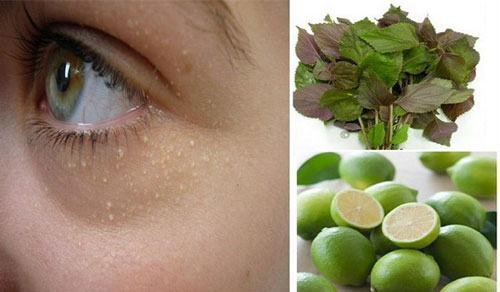 Sự kết hợp giữa kinh giới và tía tô chính là giải pháp đẩy lùi mụn thịt quanh mắt, mũi cũng như toàn mặt vô cùng hiệu quả. Trị mụn thịt bằng lá tía tô