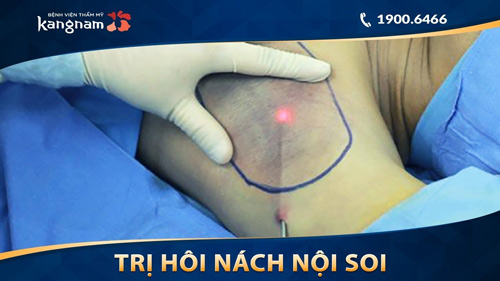 cách trị hôi nách cho bà đẻ