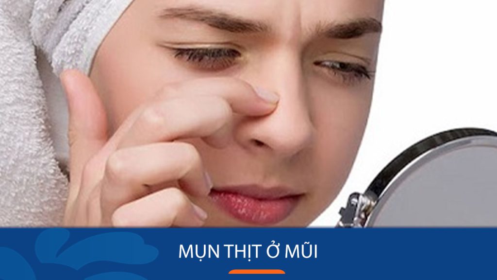 Cách trị Mụn thịt ở mũi : Bí Quyết Loại Bỏ Mụn Thịt Ở Mũi Nhanh Chóng