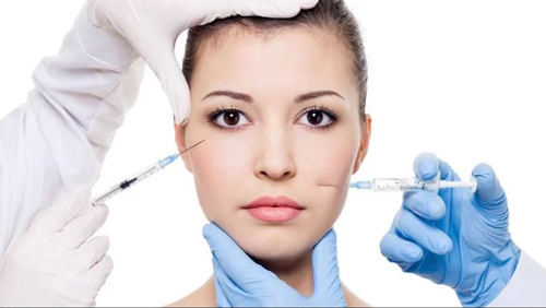 Làm đầy rãnh mũi má bằng Filler giúp xóa nhanh các nếp nhăn tự nhiên làm đầy rãnh mũi má