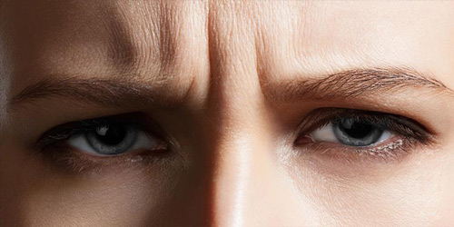 xóa nếp nhăn quanh mắt Nheo mắt và cau mày sẽ khiến nếp nhăn ở mắt hình thành nhiều hơn