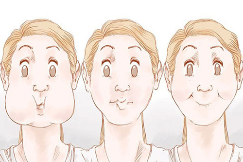 Thực hiện động tác phồng má để kéo căng các mô cơ, hạn chế nếp gấp nhăn vùng mũi, má nếp nhăn ngang mũi