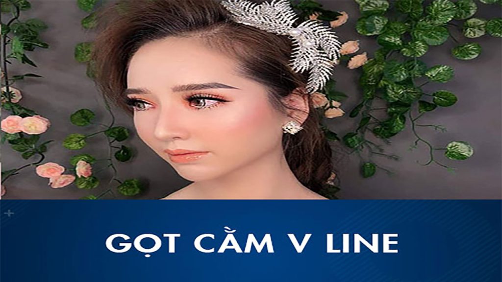 Gọt cằm V-line là gì? Quy trình, chi phí, hồi phục và rủi ro cần biết