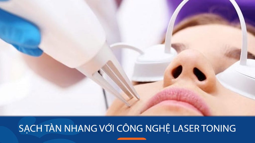 Sạch tàn nhang, sáng da với công nghệ Laser Toning