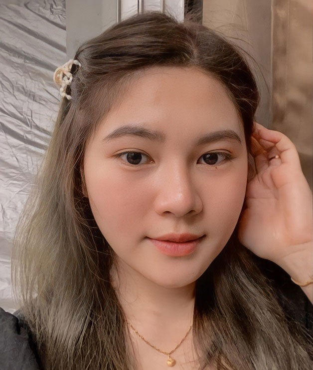 Phẫu thuật hàm mặt Vline rất an toàn và mang đến kết quả cao