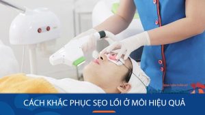 Sẹo lồi ở môi: Nguyên nhân, triệu chứng và cách điều trị hiệu quả