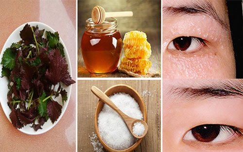 Bộ ba muối, mật ong và tía tô trị mụn thịt vô cùng hiệu quả trị mụn thịt quanh mắt bằng lá tía tô