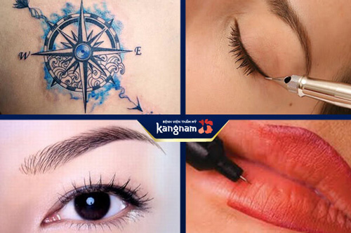 xóa hình xăm giá bao nhiêu