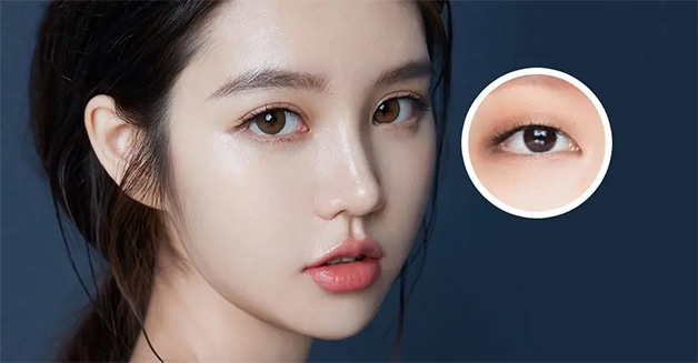 Bấm mí có bị sưng không