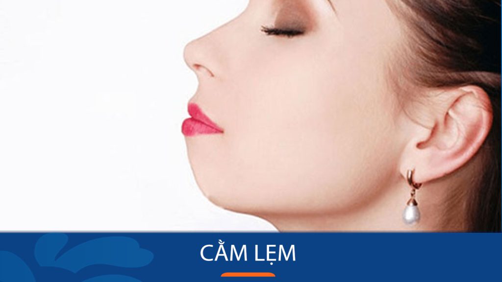 Cằm lẹm: Nguyên nhân, biểu hiện và cách khắc phục hiệu quả