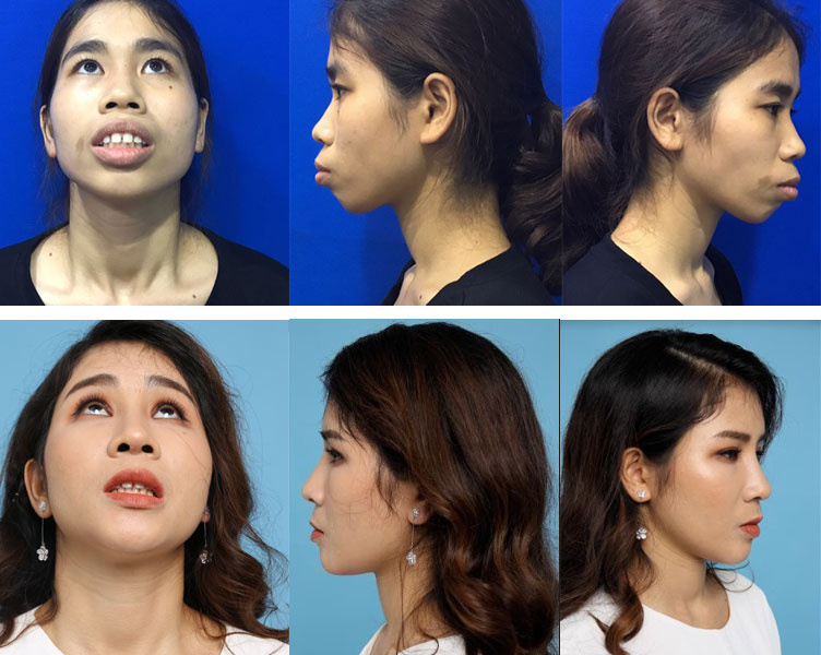 Cao Thị Lan xinh như hotgirl, đẹp mọi góc nhìn: nghiêng trái, thẳng, nghiêng phải cao thị lan trước sau