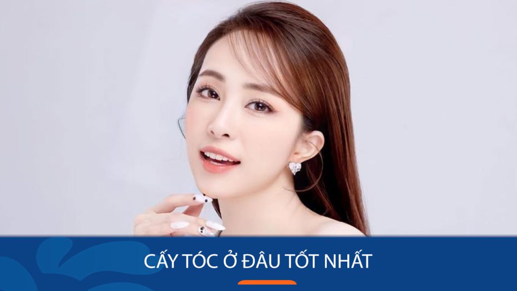 Cấy tóc ở đâu tốt nhất? Tiêu chí lựa chọn và các địa chỉ uy tín tại Hà Nội và TPHCM