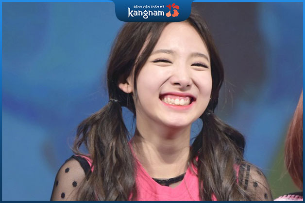 Cười hở có di truyền không?