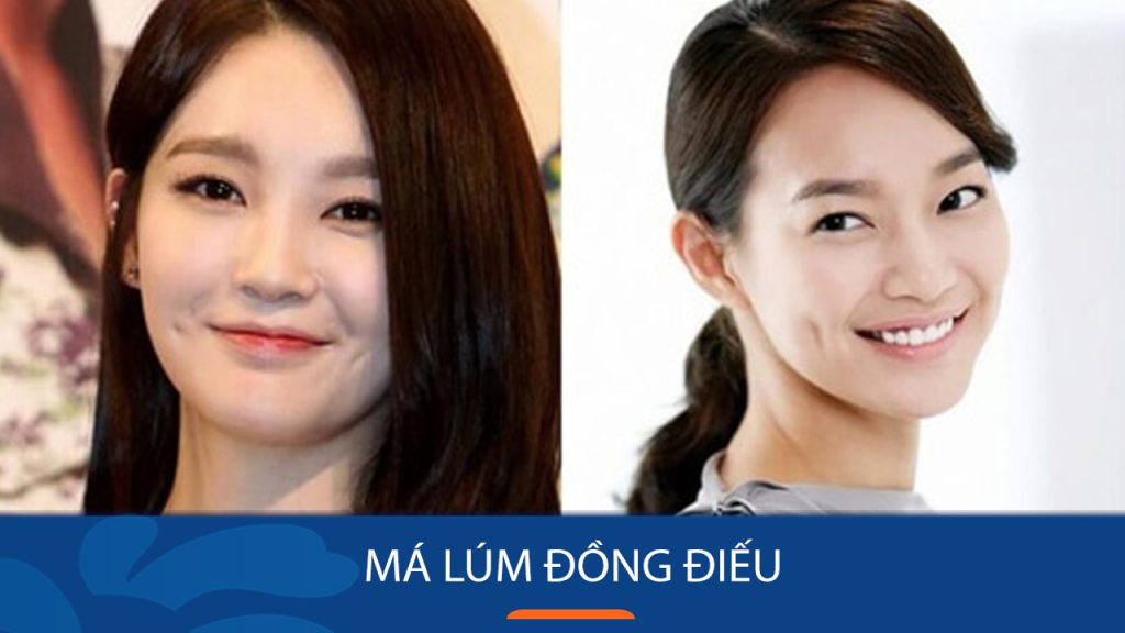 Má lúm đồng điếu: Từ bí ẩn nhân tướng học đến phương pháp tạo hình thẩm mỹ