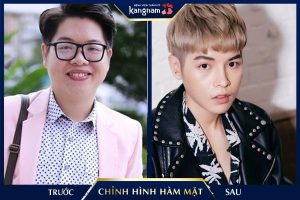 Bạn đã biết: Đức Phúc phẫu thuật thẩm mỹ ở đâu chưa? Tiết lộ địa chỉ