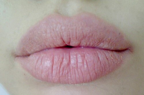 Tuổi tác càng cao làm cho đôi môi trở nên nhăn nheo, thiếu sức sống Môi thiếu dưỡng chất gây tình trạng khô ráp