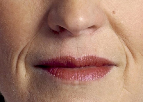 Tại sao môi nhiều nếp nhăn? Môi thiếu độ ẩm và xuất hiện nếp nhăn
