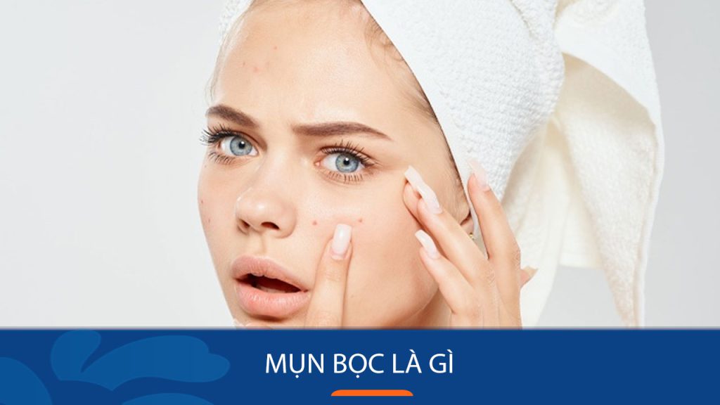 Vì sao da bạn nổi mụn bọc? Giải mã nguyên nhân và cách điều trị hiệu quả