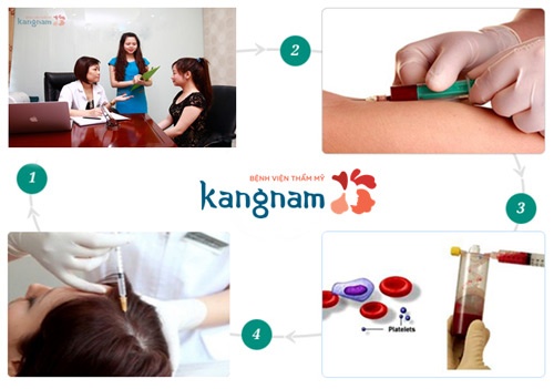 Kangnam xây dựng riêng quy trình cấy tóc chuẩn, được Bộ y tế kiểm nghiệm an toàn chất lượng quy trình cấy tóc