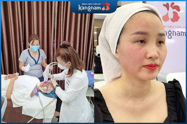 Chỉ với 1 lần thực hiện duy nhất, Thermage cho phép kéo lại đến 10 năm tuổi xuân