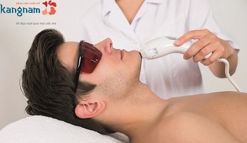 triệt râu kangnam 