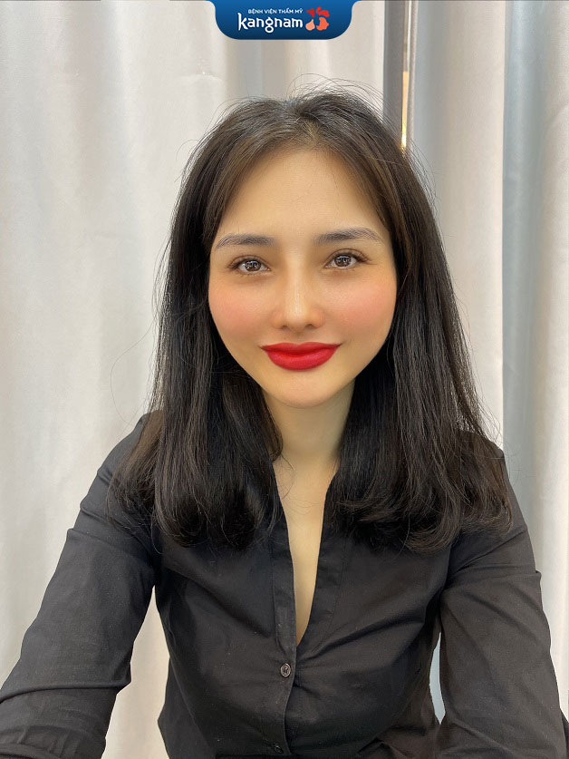 Khách hàng sau khi phun môi pha lê tại Kangnam