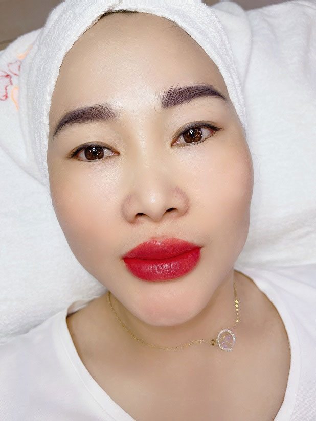 Kết quả khách hàng sau khi phun môi sửa lại